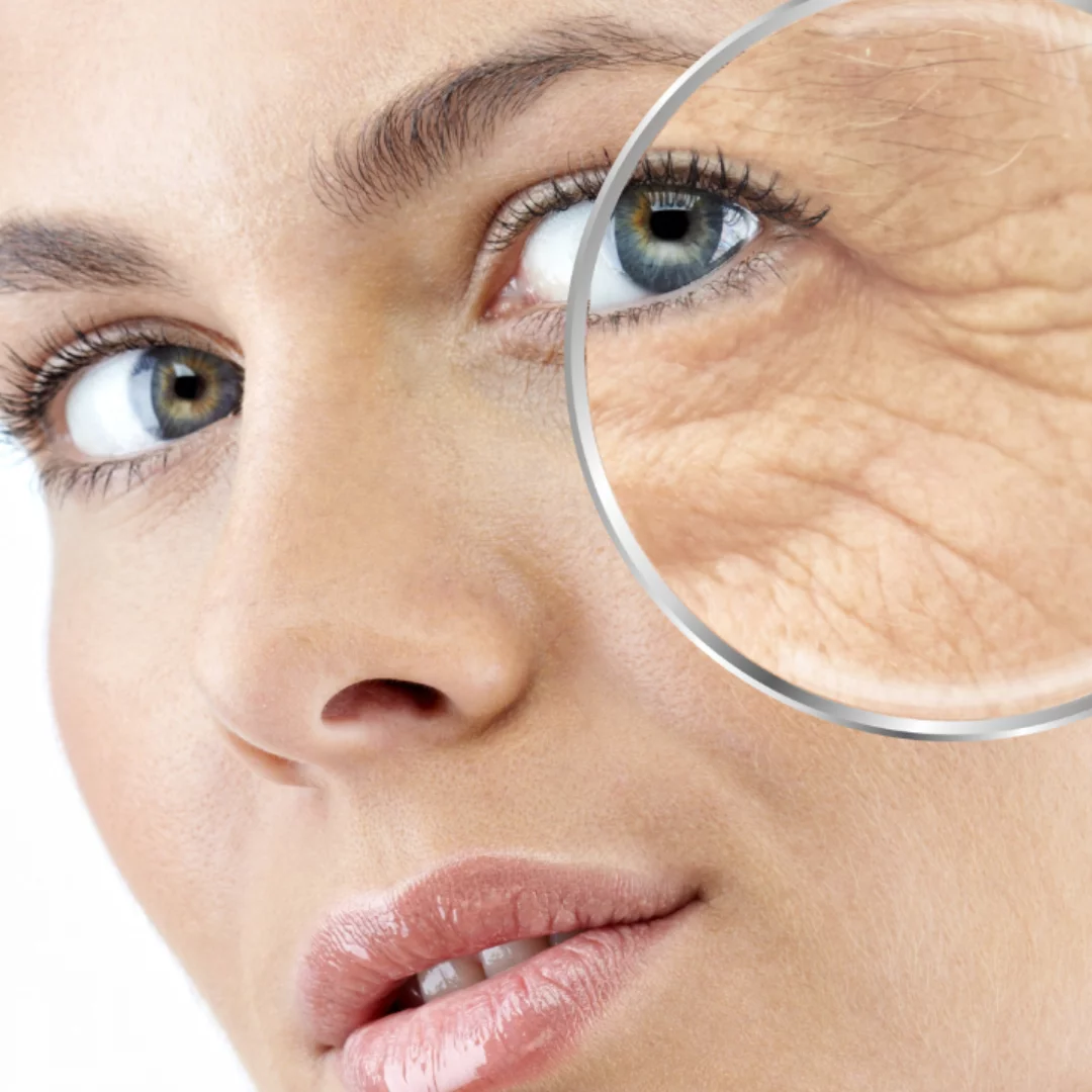 Rodzaje zmarszczek i przyczyny ich powstawania